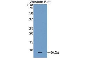 Western blot analysis of the recombinant protein. (CCL22 antibody  (AA 29-92))