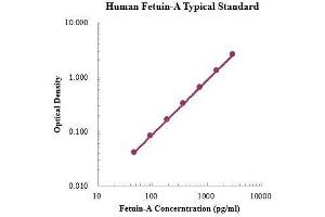 ELISA image for alpha-2-HS-Glycoprotein (AHSG) ELISA Kit (ABIN3198427) (Fetuin A ELISA Kit)