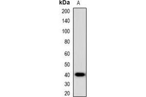 Western blot analysis of CCR5 expression in HEK293T (A) whole cell lysates. (CCR5 antibody)