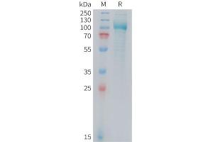 Mouse PSMA Protein, His Tag on SDS-PAGE under reducing condition. (PSMA Protein (AA 45-752) (His tag))