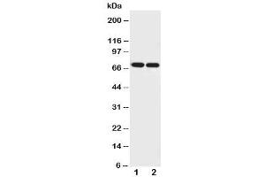 Western blot testing of Netrin 1 antibody and Lane 1:  U87 (Netrin 1 antibody  (AA 32-51))