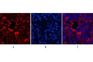 Immunofluorescence analysis of mouse lung tissue. (LC3B antibody)