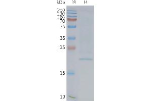 SDS-PAGE (SDS) image for Epithelial Membrane Protein 2 (EMP2) protein (ABIN7538226)