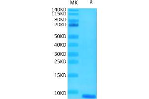 SDS-PAGE (SDS) image for Epidermal Growth Factor (EGF) protein (ABIN7274522)