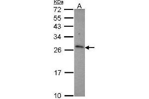WB Image Sample (30 ug of whole cell lysate) A: JurKat 12% SDS PAGE CD27L (CD70) antibody antibody diluted at 1:1000 (CD70 antibody  (C-Term))