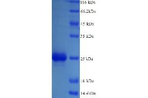 SDS-PAGE (SDS) image for Ribose 5-Phosphate Isomerase A (RPIA) (AA 1-219), (full length) protein (ABIN5714306) (Ribose 5-Phosphate Isomerase A (RPIA) (AA 1-219), (full length) Protein)