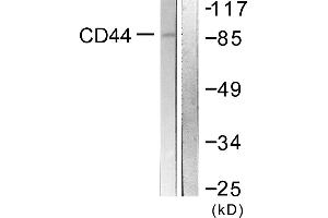 Western blot analysis of extracts from NIH/3T3 cells, treated with PMA (250ng/ml, 5mins), using CD44 (Ab-706) antibody. (CD44 antibody)