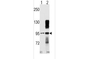 Western blot analysis of TYRO10 using rabbit polyclonal TYRO10 Antibody using 293 cell lysates (2 ug/lane) either nontransfected (Lane 1) or transiently transfected with the DDR2 gene (Lane 2). (DDR2 antibody)