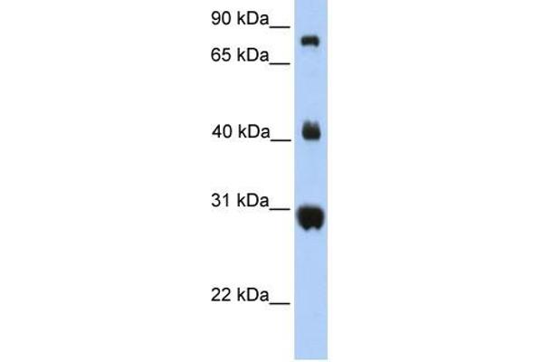 FIBCD1 antibody  (C-Term)