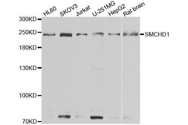SMCHD1 antibody  (AA 1756-2005)