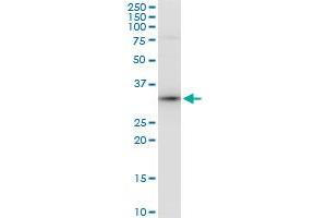 PPIE polyclonal antibody (A01), Lot # 060524JCS1. (PPIE antibody  (AA 2-100))