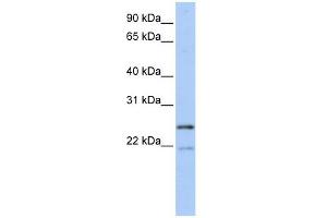 BTF3L3 antibody used at 1 ug/ml to detect target protein. (BTF3P13 antibody  (Middle Region))