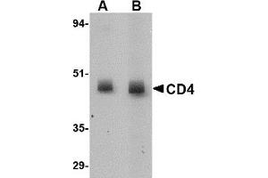 Western Blotting (WB) image for anti-CD4 (CD4) antibody (ABIN1031728) (CD4 antibody)