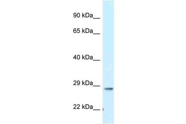 TMEM106B anticorps  (C-Term)