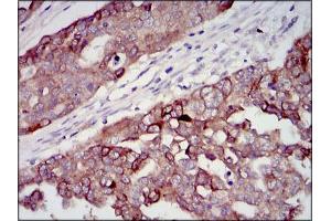 Immunohistochemistry (IHC) image for anti-Insulin-Like Growth Factor 2 (IGF2) (AA 25-180) antibody (ABIN1098108)