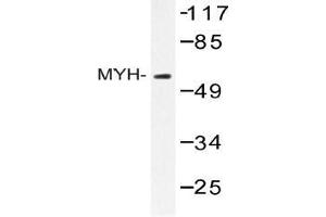 Western blot analysis of MUTYH antibody in extracts from HepG2 cells. (MUTYH antibody)