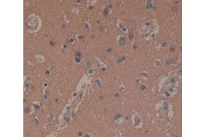 DAB staining on fromalin fixed paraffin- embedded brain tissue) (SNAP25 antibody  (AA 1-206))