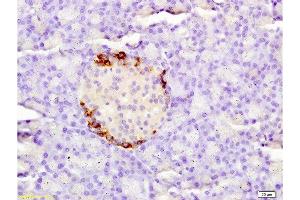 Immunohistochemistry (Paraffin-embedded Sections) (IHC (p)) image for anti-Coagulation Factor III (thromboplastin, Tissue Factor) (F3) (AA 32-100) antibody (ABIN708086)