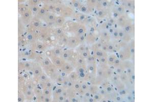 IHC-P analysis of Human Tissue, with DAB staining. (Catalase antibody  (AA 32-167))