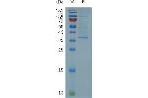 Human C Protein, hFc Tag on SDS-PAGE under reducing condition. (Claudin 5 Protein (CLDN5) (AA 29-81) (Fc Tag))