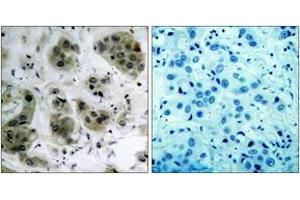 Immunohistochemistry (IHC) image for anti-AKT 1/2/3 (AA 431-480) antibody (ABIN2888942) (AKT 1/2/3 antibody  (AA 431-480))