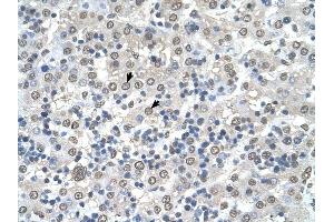 CDR2 antibody was used for immunohistochemistry at a concentration of 4-8 ug/ml to stain Hepatocytes (arrows) in Human Liver. (CDR2 antibody  (N-Term))