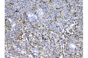 IHC analysis of Neurocan using anti-Neurocan antibody . (Neurocan antibody)