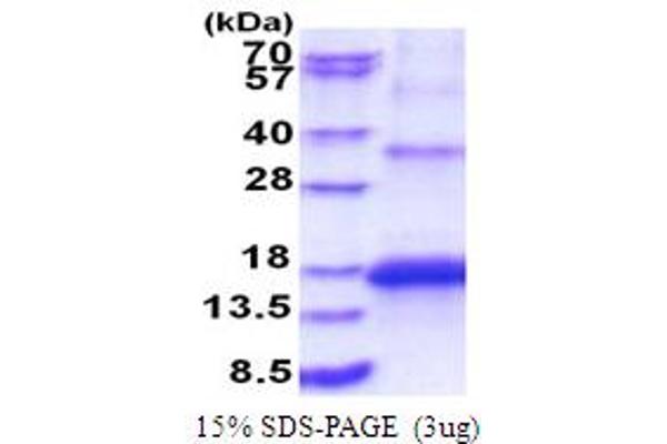 KCNMB3 Protein (AA 82-207) (His tag)