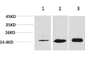 Western blot analysis of 1) Hela, 2) 3T3, 3) rat brain tissue using MAP LC3β Polyclonal Antibody. (LC3B antibody)