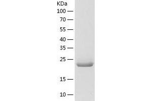 Western Blotting (WB) image for Linker For Activation of T Cells (LAT) (AA 28-233) protein (His tag) (ABIN7123771) (LAT Protein (AA 28-233) (His tag))