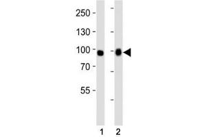 Western blot analysis of lysate from (1) A549 and (2) HeLa cell line using FGFR3 antibody at 1:1000. (FGFR3 antibody  (AA 449-482))