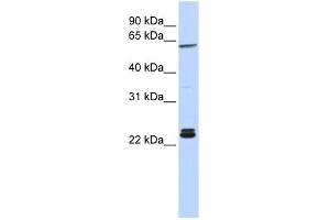 H1F0 antibody used at 1 ug/ml to detect target protein. (Histone H1 antibody  (N-Term))