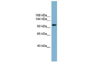 ACLY antibody used at 1 ug/ml to detect target protein. (ACLY antibody  (Middle Region))