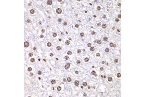 Immunohistochemistry of paraffin-embedded mouse liver using TOP1 antibody (ABIN6290286) at dilution of 1:100 (40x lens). (Topoisomerase I antibody)