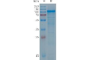 PTGFRN Protein (AA 26-830) (His tag)