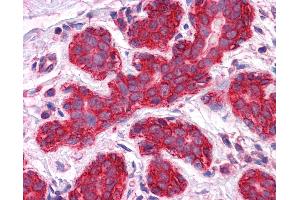 Anti-Gamma Catenin antibody IHC of human breast. (JUP antibody  (AA 1-746))