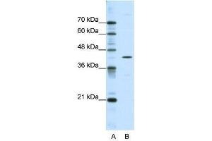 Western Blot showing DOK2 antibody used at a concentration of 1-2 ug/ml to detect its target protein. (DOK2 antibody  (C-Term))