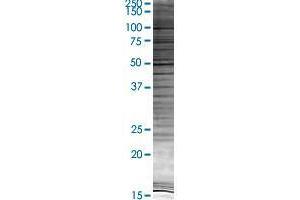 DKK1 transfected lysate. (DKK1 293T Cell Transient Overexpression Lysate(Denatured))