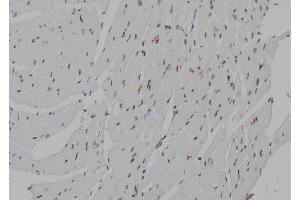 ABIN6273462 at 1/100 staining Mouse heart tissue by IHC-P. (CENPN antibody  (C-Term))