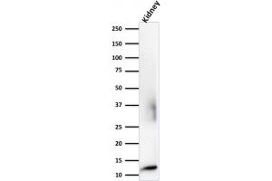 Western Blot Analysis of human kidney tissue lysates using Beta-2-Microglobulin mouse monoclonal antibody (B2M/1118). (Recombinant beta-2 Microglobulin antibody)