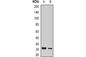 Western blot analysis of PA28 gamma expression in MCF7 (A), PC12 (B) whole cell lysates. (PSME3 antibody)