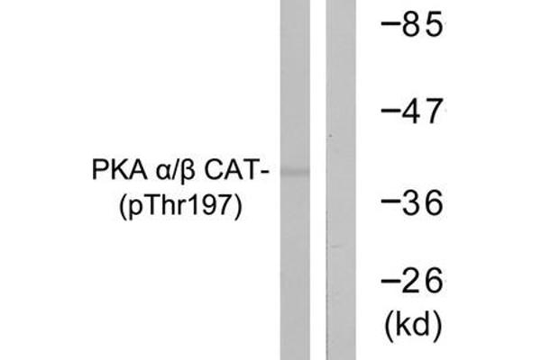 PRKACA antibody  (pThr197)