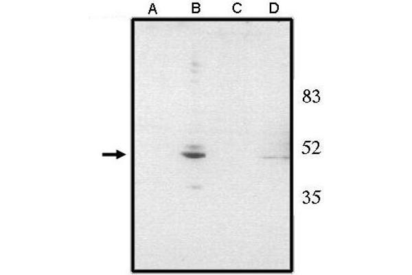 VSX2 antibody  (N-Term)