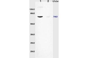 L1 human colon carcinoma lysates L2 rat brain lysates probed with Anti KIFC1 Polyclonal Antibody, Unconjugated (ABIN873143) at 1:200 overnight at 4 °C. (KIFC1 antibody)