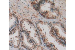 IHC-P analysis of prostate gland tissue, with DAB staining. (FTH1 antibody  (AA 1-183))