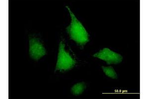 Immunofluorescence of purified MaxPab antibody to SNF1LK on HeLa cell. (SIK1 antibody  (AA 1-783))