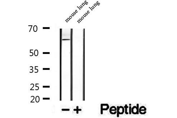 Seladin 1 antibody  (N-Term)