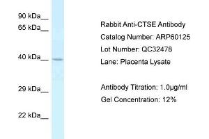 Western Blotting (WB) image for anti-Cathepsin E (CTSE) (C-Term) antibody (ABIN786088) (Cathepsin E antibody  (C-Term))