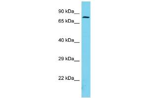 Host: Rabbit Target Name: ARMC9 Sample Type: Jurkat Whole Cell lysates Antibody Dilution: 1. (ARMC9 antibody  (N-Term))