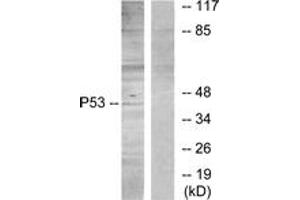 Western blot analysis of extracts from HT29 cells, using p53 (Ab-315) Antibody. (p53 antibody  (AA 281-330))